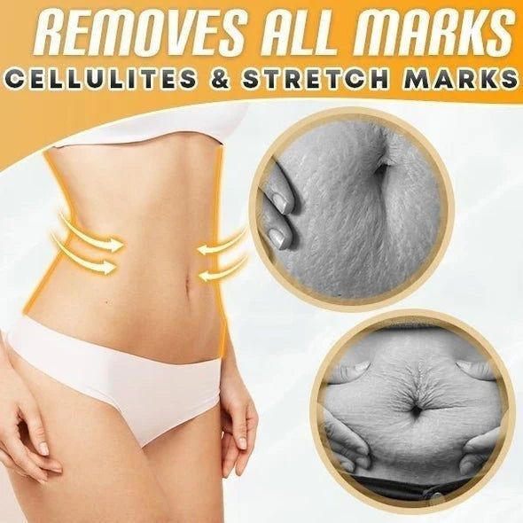 NatureSlim™ Abdominale Drainage Gemberolie | Tijdelijk 1 + 1 Gratis