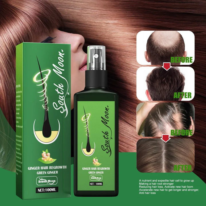 GrowthPlus™ – Voedende gemberspray voor voller haar | 1 + 1 gratis