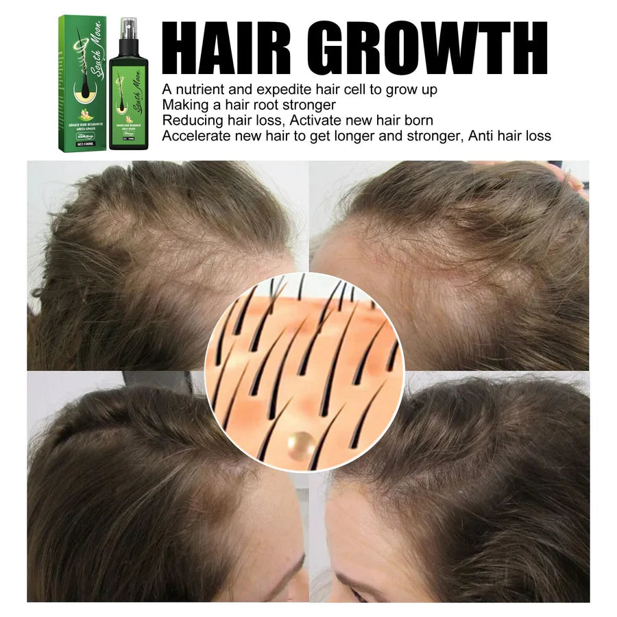 GrowthPlus™ – Voedende gemberspray voor voller haar | 1 + 1 gratis