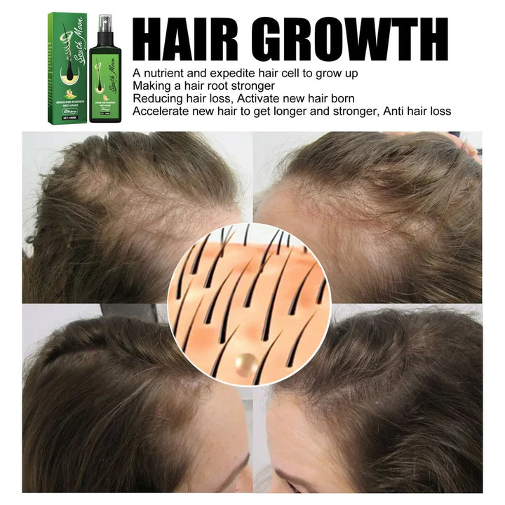 GrowthPlus™ – Voedende gemberspray voor voller haar | 1 + 1 gratis