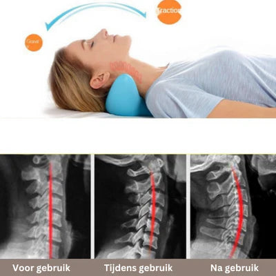 NekRelax™ Chiropractisch Nekmassageapparaat | Tijdelijk 50% Korting