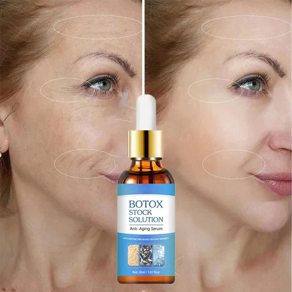 YouthSkin™ Anti-Aging Botox Serum | Tijdelijk 1 + 1 Gratis