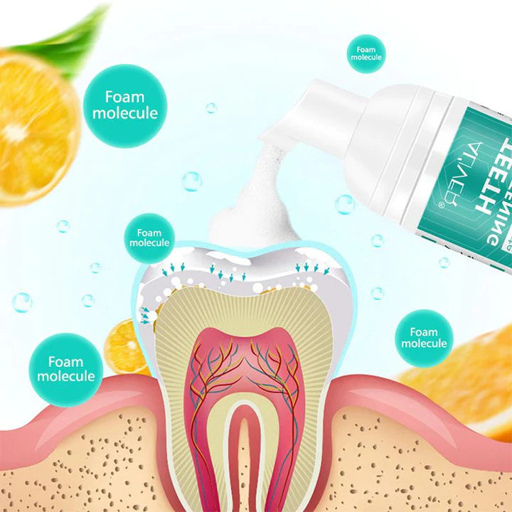WhiteSmile™ - De oplossing tegen gele tanden! | Tijdelijk 1 + 1 Gratis