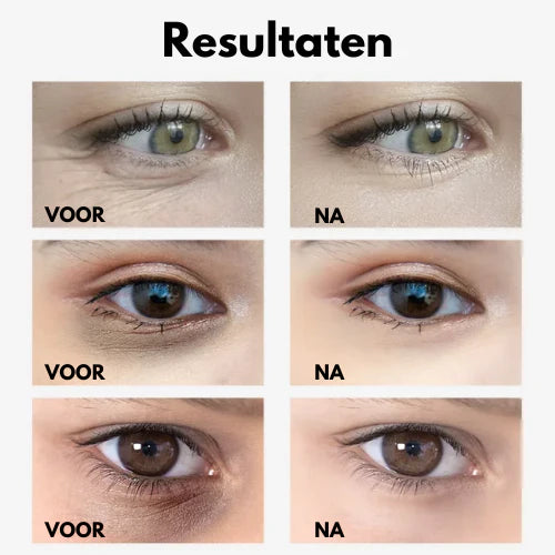 Veze™ Anti-Wallen Oogcrème | 1 + 1 Gratis