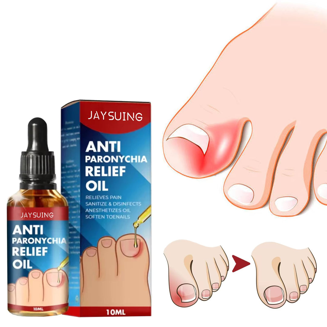 ToePerfect™ Anti paronychia verlichtingsolie | 1 + 1 Gratis